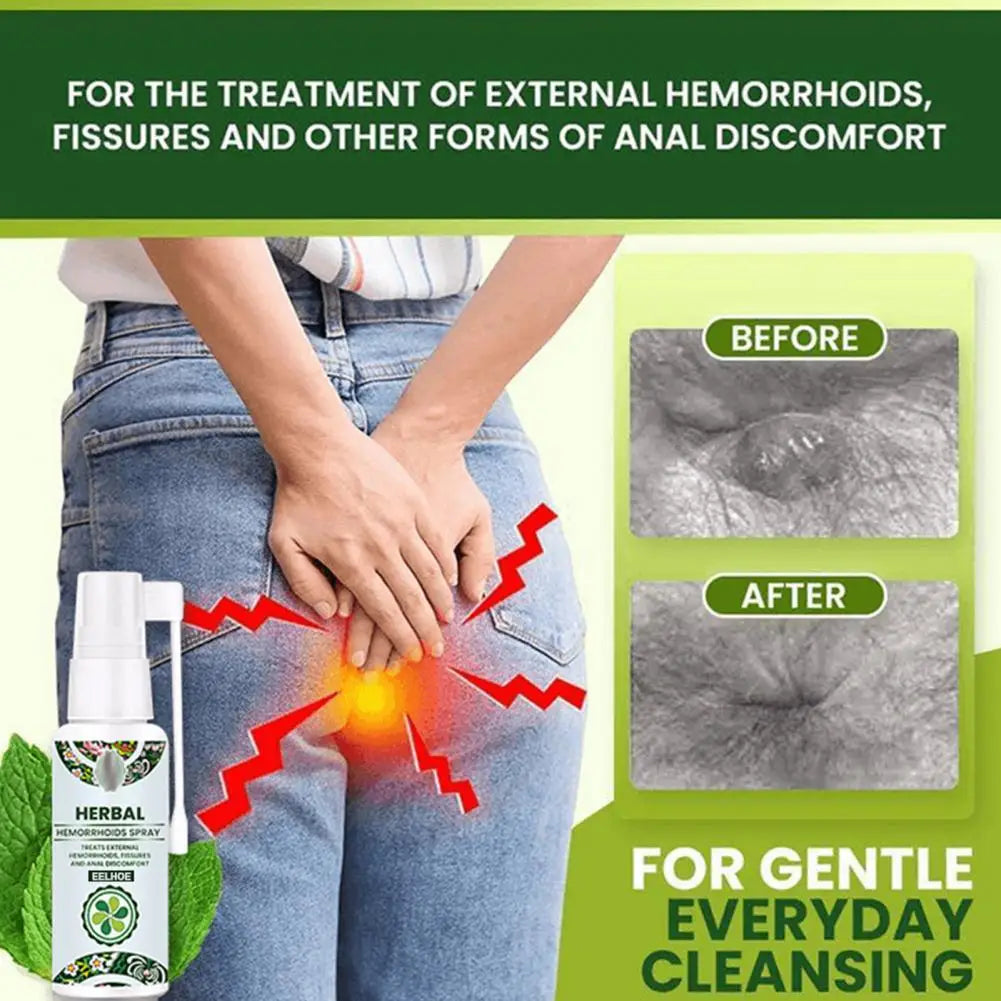 Healthy Portable Pain Relieve Anal Pain Hemorrhoids Spray Easily Operate Lightweight Anal Hemorrhoids Spray for Anal